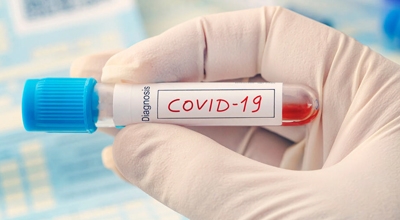 Unione dei Comuni Parte Montis, test sierologici a tariffe agevolate per i residenti